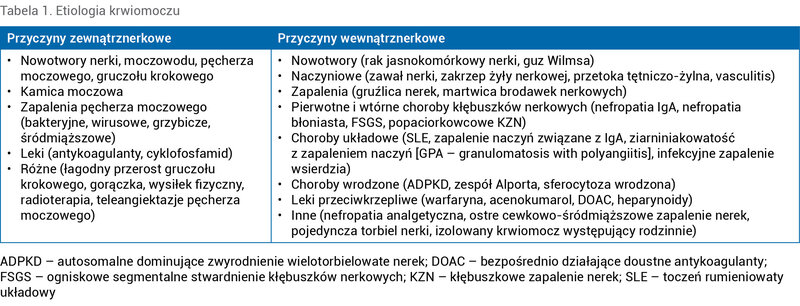 Tabela 1. Etiologia krwiomoczu