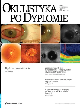 Okulistyka po Dyplomie (03/2016) 