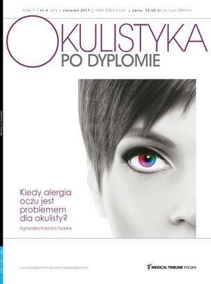 Okulistyka po Dyplomie 04/2017
