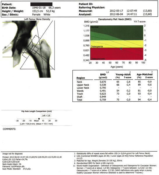 Rycina 1 i 2. Badania densytometryczne