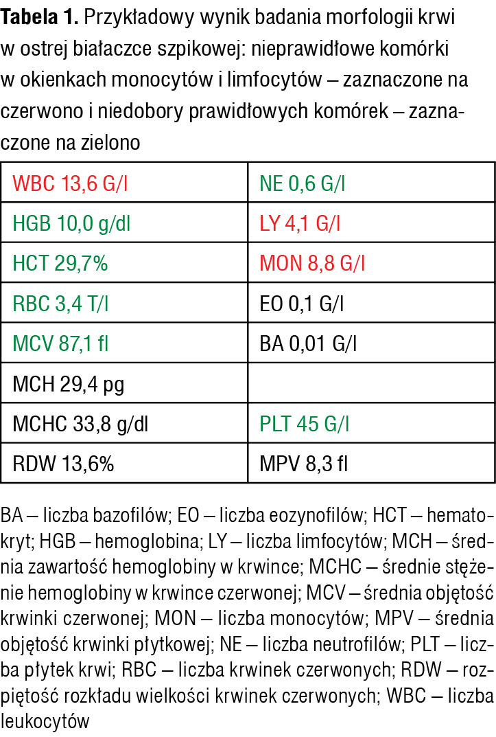 Tabela 1. Przykładowy wynik badania morfologii krwi w ostrej białaczce szpikowej: nieprawidłowe komórki w okienkach monocytów i limfocytów – zaznaczone na czerwono i niedobory prawidłowych komórek – zaznaczone na zielono
