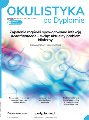 Okulistyka po Dyplomie 05/2021