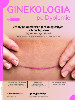 Zrosty po operacjach ginekologicznych i ich następstwa Czy możemy tego uniknąć?