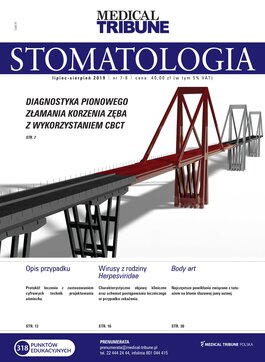 Medical Tribune Stomatologia (07-08/2019) 
