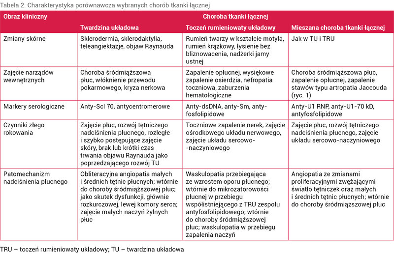 Tabela 2. Charakterystyka porównawcza wybranych chorób tkanki łącznej