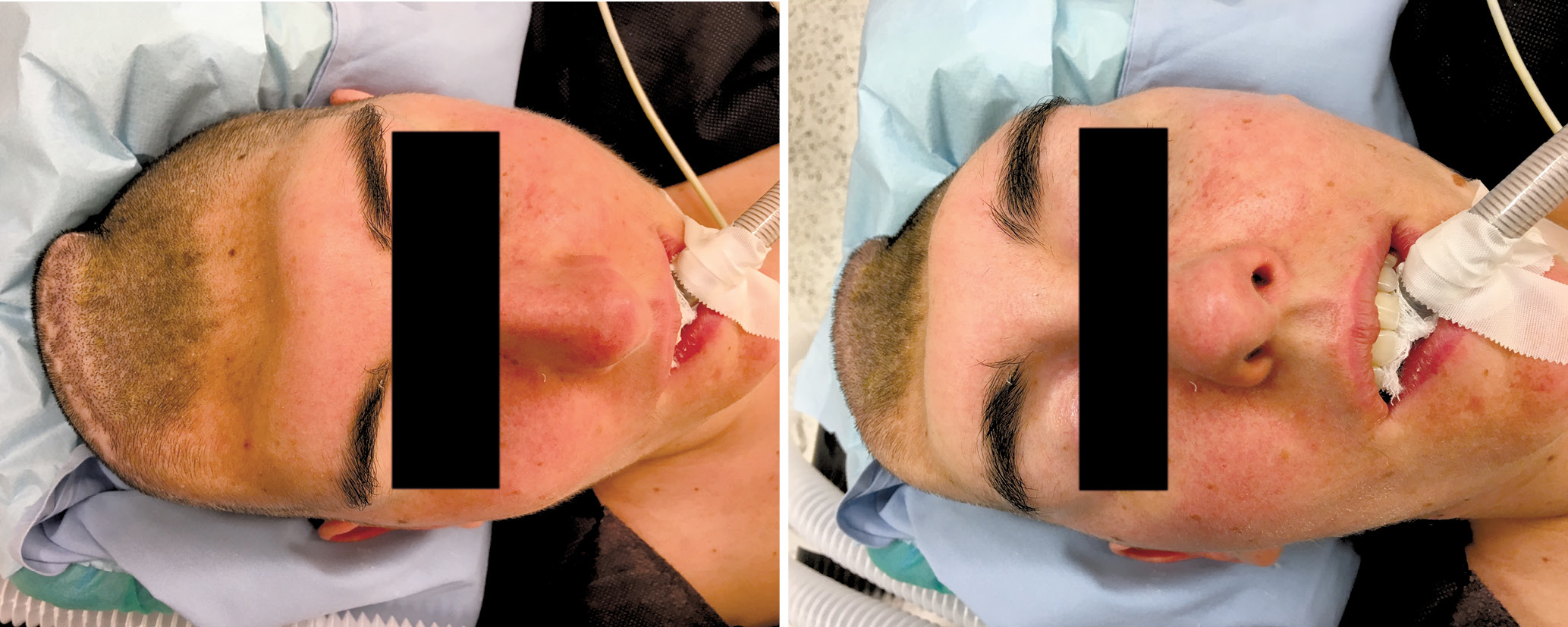 Ryc. 4, 5. Pacjentka przed zabiegiem operacyjnym.