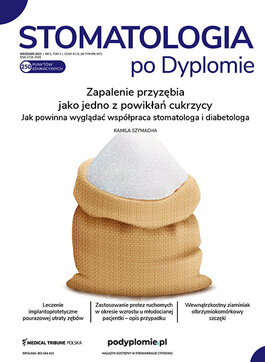 Medical Tribune - stomatologia (05/2023) 