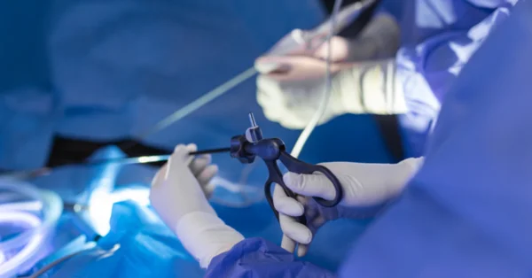 Pionierskie operacje endoskopowe w Narodowym Instytucie Onkologii