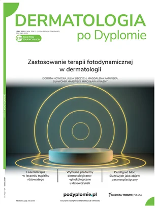 Dermatologia po Dyplomie 04/2020