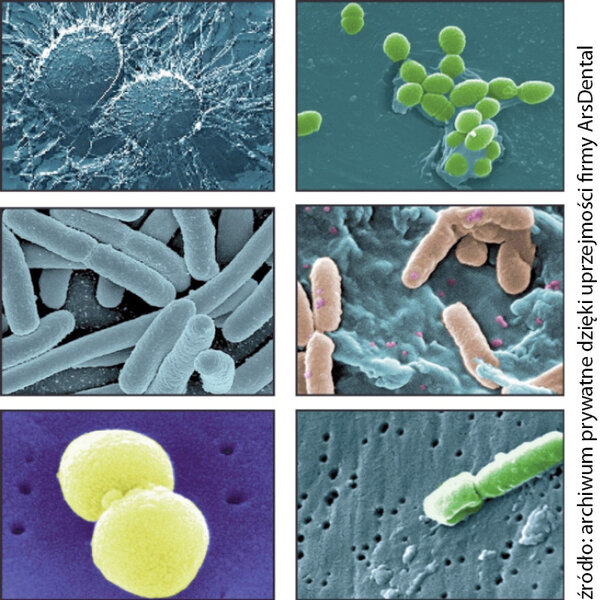 Ryc.1. Terapia PACT z zastosowaniem zieleni indocyjaniny. 