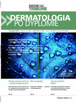 Dermatologia po Dyplomie (06/2015) 