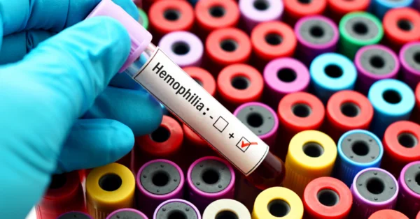 Hemofilia: najpierw podaj czynnik, potem diagnozuj