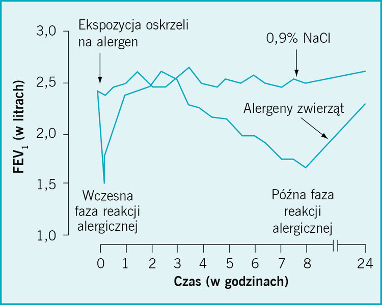  Rycina. Inhalacja całej cząsteczki alergenu