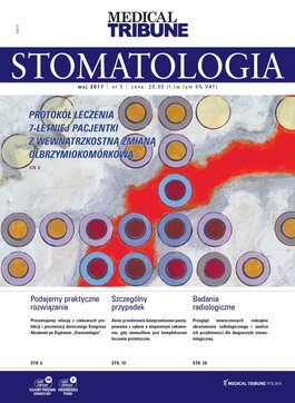 Medical Tribune - stomatologia (05/2017) 