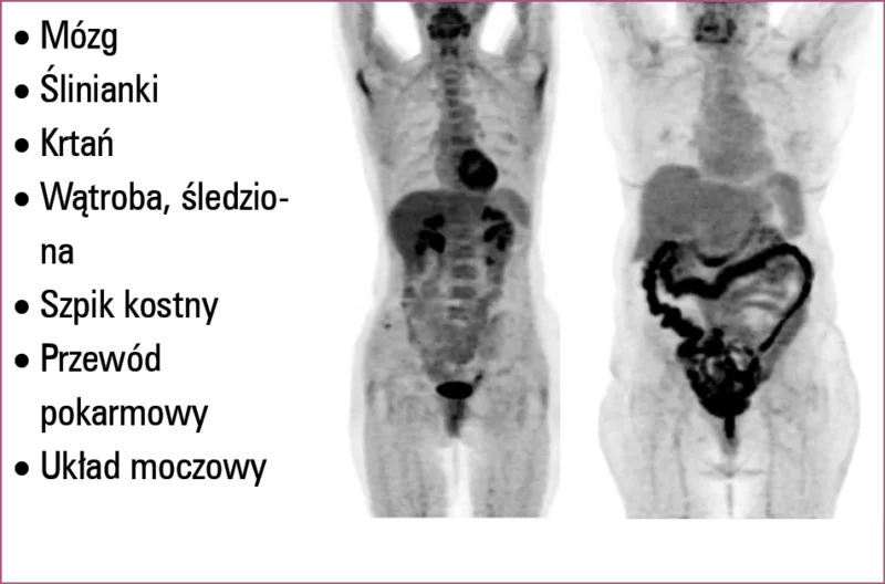 
 
 
 
 Badanie PET/CT po podaniu 18FDG – wychwyt fizjologiczny.