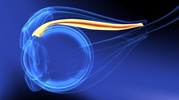Białostoccy neurochirurdzy zastosowali małoinwazyjną metodę i uratowali wzrok pacjenta