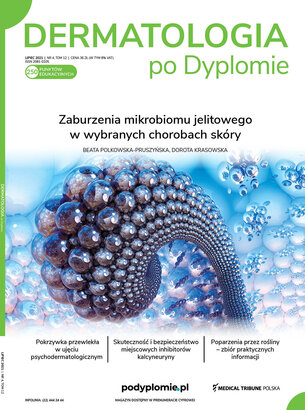 Dermatologia po Dyplomie 04/2021