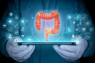 Optymalizacja opieki nad pacjentem z WZJG. Współpraca lekarza POZ i gastroenterologa
