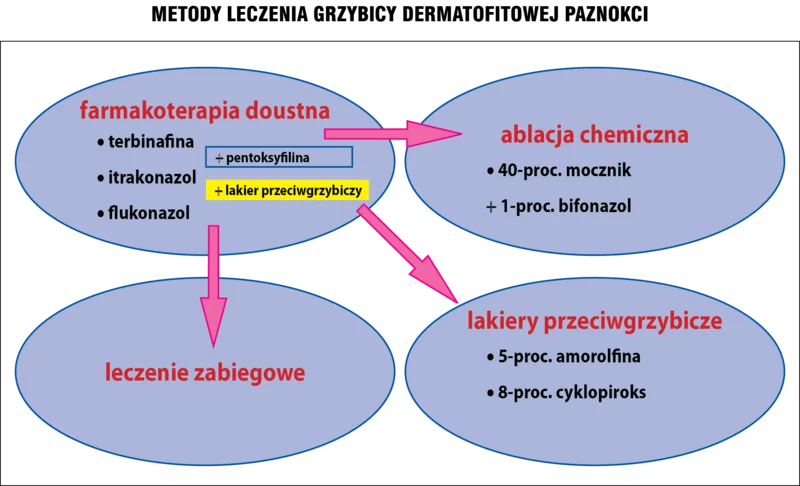 Ryc. 2. Metody leczenia grzybicy dermatofitowej paznokci.