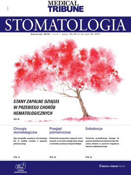 Medical Tribune Stomatologia (04/2018) 