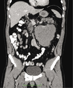 Small nasieniak ryc1 opt