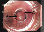 Small ryc 2 opt