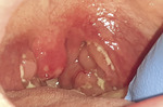 Small ryc. 3 opt