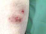 Small derm 351 rycina 1 opt