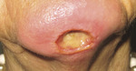 Small derm 351 rycina 2 opt