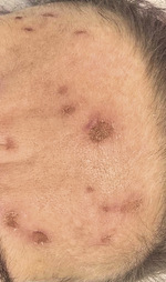 Small derm 351 rycina 3 opt