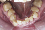 Small rycina 6 1 opt