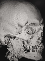 Small obraz2 opt