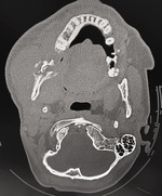 Small obraz4 opt