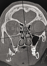 Small obraz5 opt