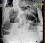 Small rycina 1 niedrozno%c5%9bc w opt