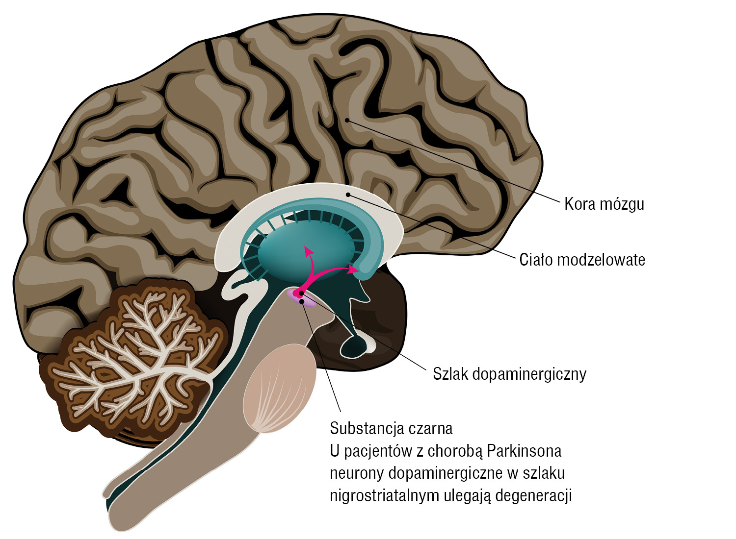 Neurologia Po Dyplomie Choroba Parkinsona 