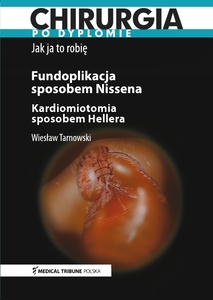 Jak ja to robię: Fundoplikacja sposobem Nissena Kardiomiotomia sposobem Hellera (film DVD)