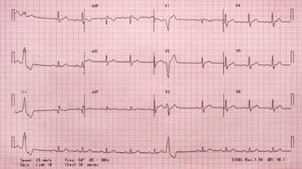 Gettyimages 1221437390 612x612