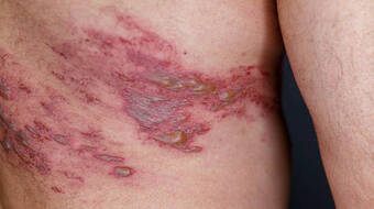 Gettyimages 1434381063 612x612