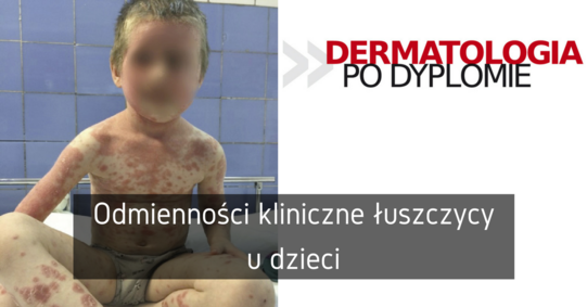 Fb artyku%c5%81 otwarty %283%29